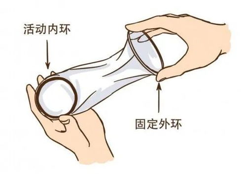 女用避孕套使用指南 安全套正确操作全过程详解